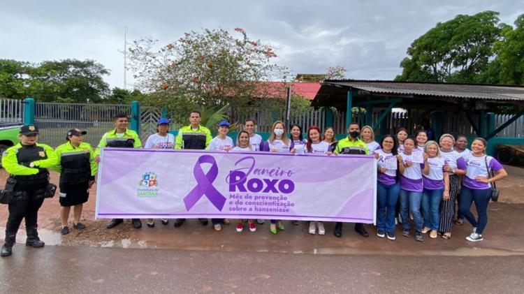Janeiro Roxo: Ações educativas e de conscientização sobre a hanseníase