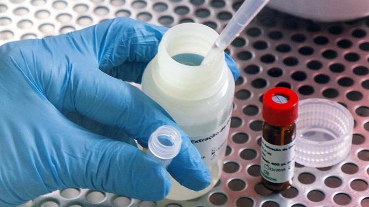 Sequenciamento genético não detecta variante delta no Amapá